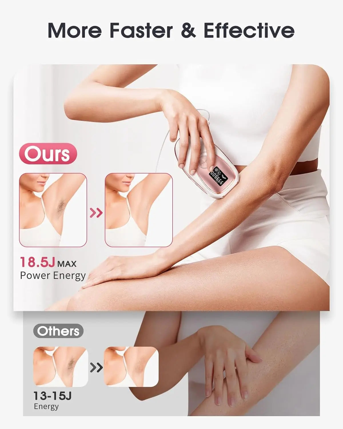 SilkPulse™ IPL Hair Removal